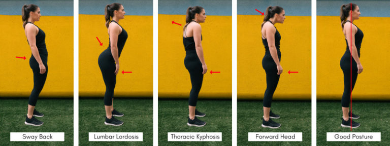 How To Fix Bad Posture 11 Exercises That Actually Work 