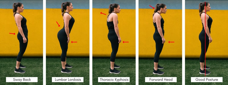 types of Bad Posture and what good posture looks like