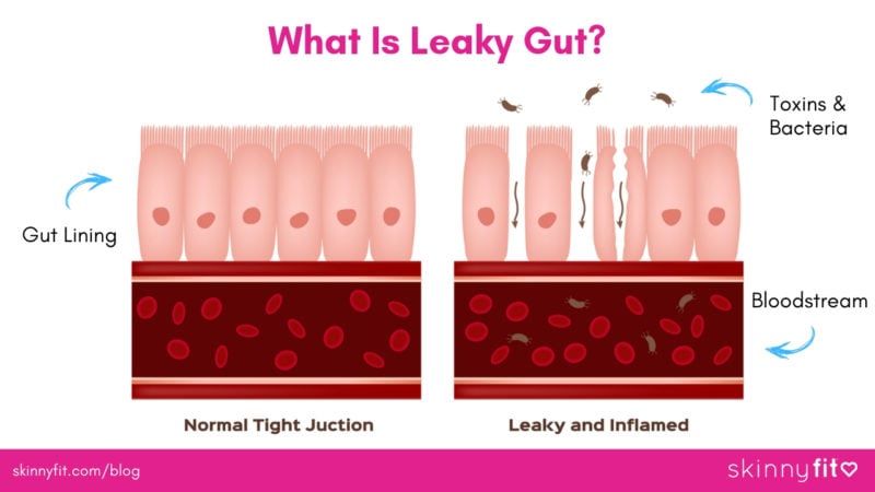 collagen for leaky gut