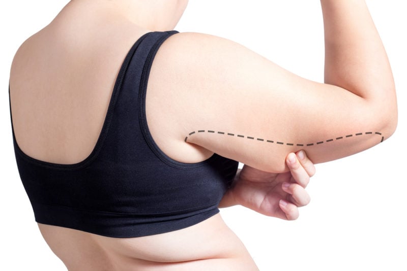 lose arm fat: What Causes Arm Fat in Females? How Can You Lose Arm Fat  Quickly?