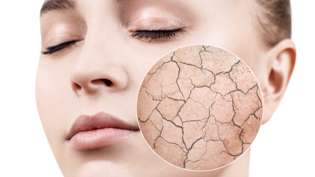 5 Signs You Have Dehydrated Skin How To Fix It 7123